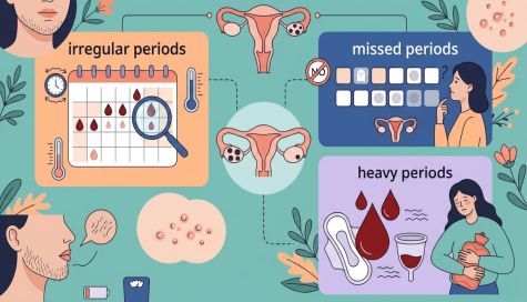 How PCOS Affects Your Periods and Early Warning Signs